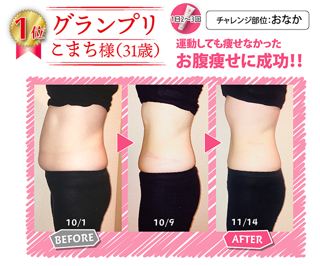 第1位受賞者のビフォーアフター写真