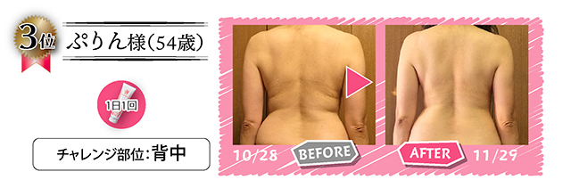 第3位受賞者のビフォーアフター写真