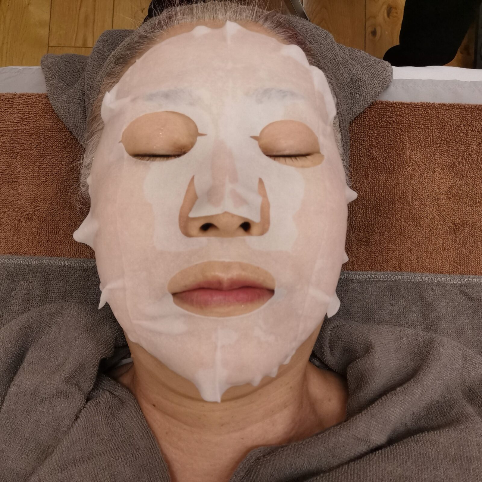 施術後NMNシートパックで保湿